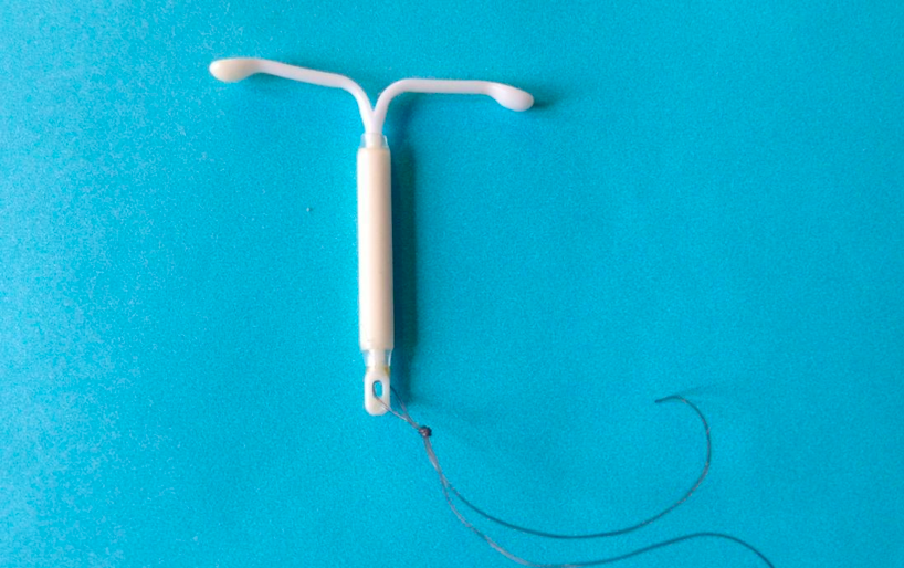 IUD chứa progestin đưa vào tử cung 