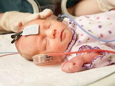 Đo thính lực: Xét nghiệm giảm ở trẻ sơ sinh