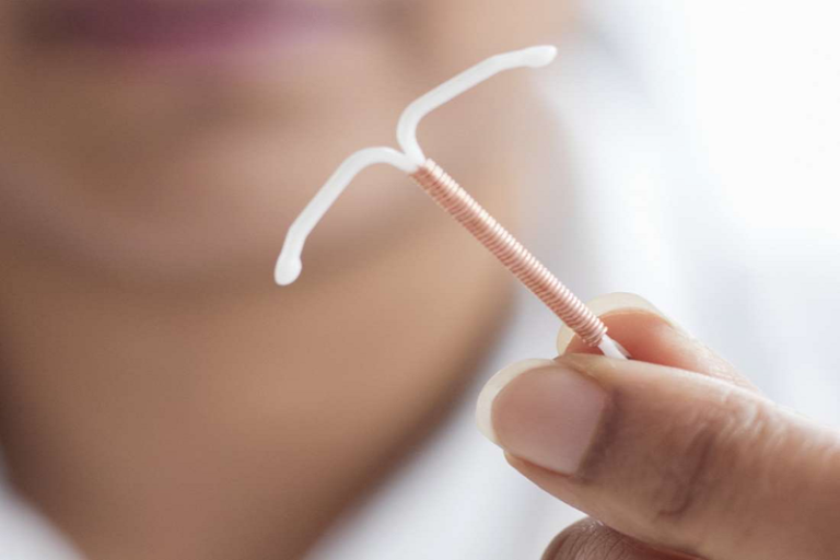 Đặt vòng tránh thai có những loại nào và nên lưu ý những gì?